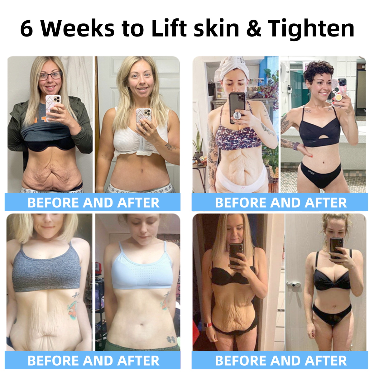 🩵🌊Siste dag med rabatt: 75% AVSLAG -💦Fubsta™ Hudløftende Rynkefjerningskrem: Gjenopprett hudens elastisitet - 2024🧖♀️