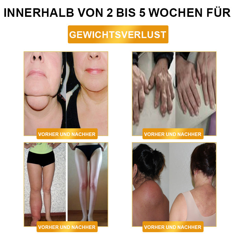 🎉🎉Begrenset tidsrabatt⚕️𝗨𝗹𝘁𝗿𝗮𝘀𝗼𝗻𝗶𝘀𝗸 𝗙𝗲𝘁𝘁𝗳𝗼𝗿𝗯𝗿𝗲𝗻𝗻𝗶𝗻𝗴 & 𝗙𝗷𝗲𝗿𝗻𝗶𝗻𝗳𝗿𝗮𝗿ø𝗱 𝗕𝗹𝗼𝗱𝘀𝘂𝗸𝗸𝗲𝗿𝗯𝗮𝗹𝗮𝗻𝘀𝗲𝗿𝗶𝗻𝗴 𝗗𝗲𝘁𝗼𝘅 𝗔𝗿𝗺𝗯å𝗻𝗱 - 𝗘𝗻𝗲𝗿𝗴𝗶𝗯𝗮𝗹𝗮𝗻𝘀𝗲