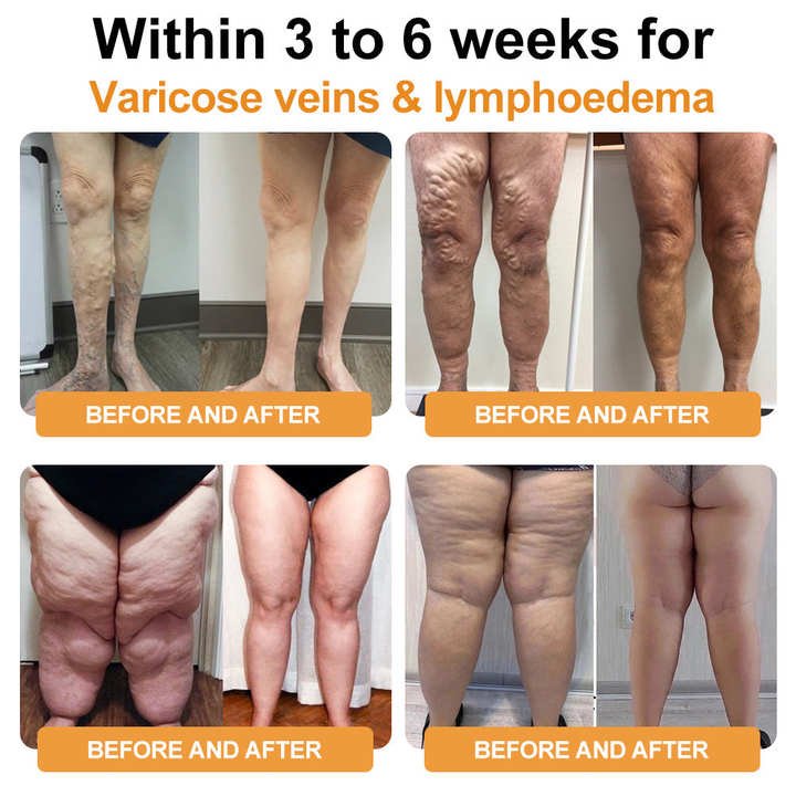 🎉🎉Begrenset tidsrabatt⚕️𝗨𝗹𝘁𝗿𝗮𝘀𝗼𝗻𝗶𝘀𝗸 𝗙𝗲𝘁𝘁𝗳𝗼𝗿𝗯𝗿𝗲𝗻𝗻𝗶𝗻𝗴 & 𝗙𝗷𝗲𝗿𝗻𝗶𝗻𝗳𝗿𝗮𝗿ø𝗱 𝗕𝗹𝗼𝗱𝘀𝘂𝗸𝗸𝗲𝗿𝗯𝗮𝗹𝗮𝗻𝘀𝗲𝗿𝗶𝗻𝗴 𝗗𝗲𝘁𝗼𝘅 𝗔𝗿𝗺𝗯å𝗻𝗱 - 𝗘𝗻𝗲𝗿𝗴𝗶𝗯𝗮𝗹𝗮𝗻𝘀𝗲