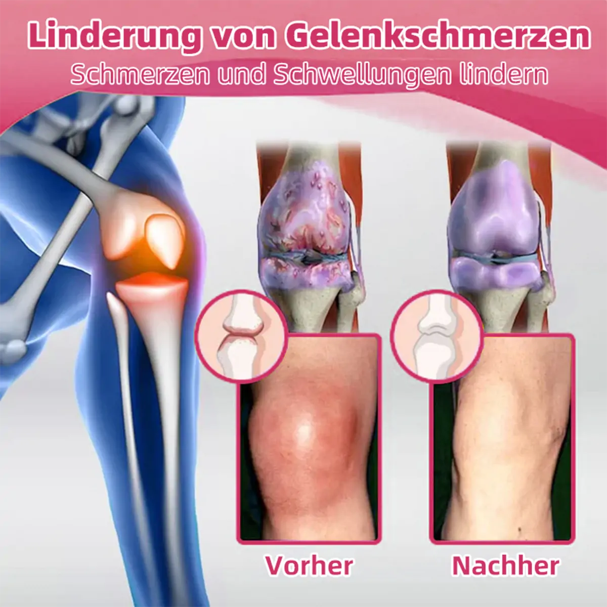 ๐ฅ๐ฅ๐๐ง๐ง๐๐๐๐ฒยฎ Biegift Smertelindrende og Behandlende Krem for Benhelse๐จโโ๏ธ๐ค (Spesielt for eldre voksne og anbefalt av DGOU)๐