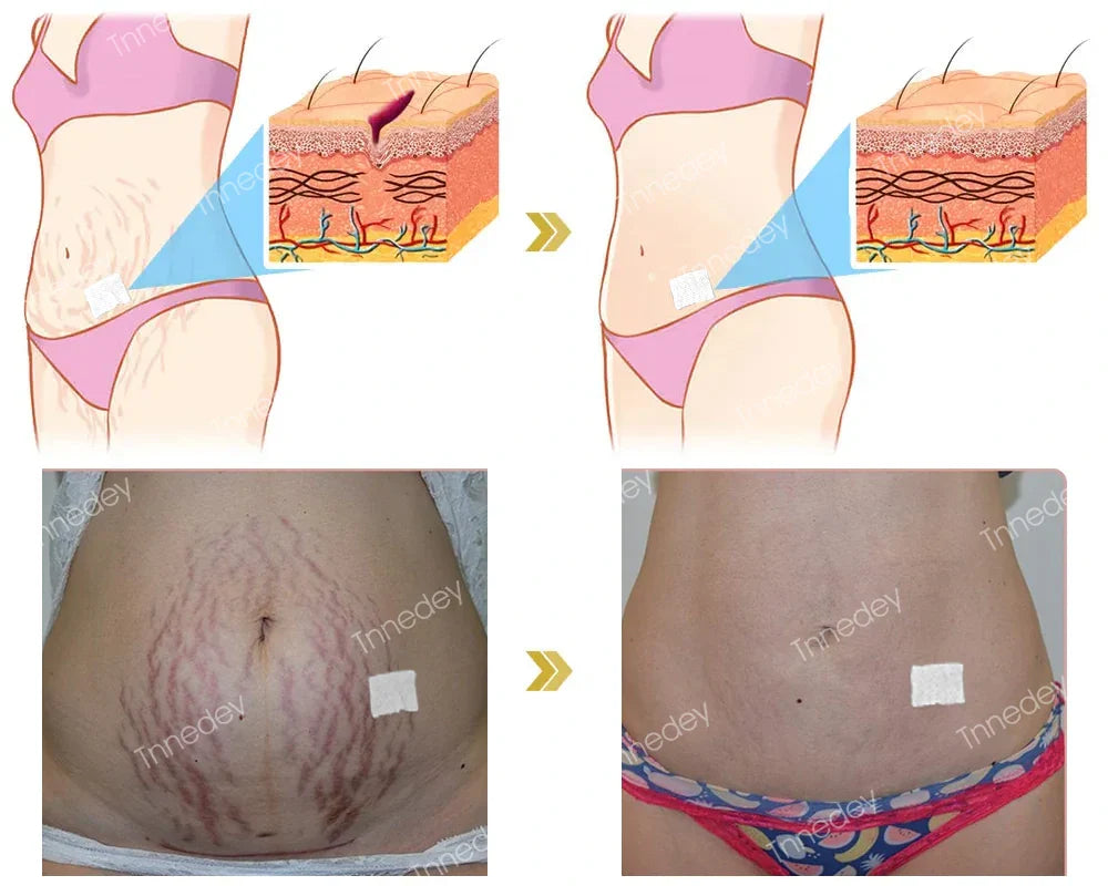 Tnnedey® NAD+ Biegiftplaster – Ultimate Hudfornyelse & Energiboost (Siste dag med rabatt: 75%) ⚡👩🔬