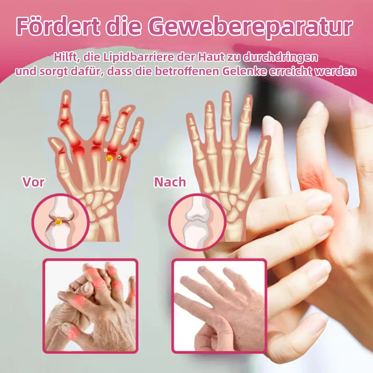 ๐ฅ๐ฅ๐๐ง๐ง๐๐๐๐ฒยฎ Biegift Smertelindrende og Behandlende Krem for Benhelse๐จโโ๏ธ๐ค (Spesielt for eldre voksne og anbefalt av DGOU)๐