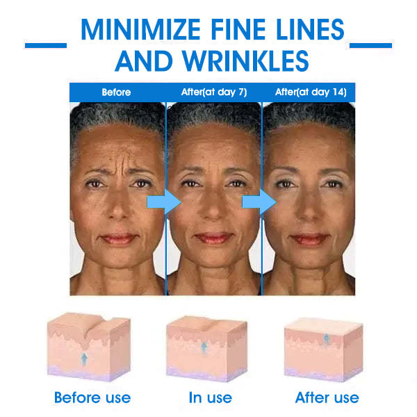 𝐒𝐢𝐬𝐭𝐞 𝐃𝐚𝐠 𝐌𝐞𝐝 𝐑𝐚𝐛𝐚𝐭𝐭: 𝟕5% 𝐀𝐕𝐒𝐋𝐀𝐆🩵🌊𝐅𝐮𝐛𝐬𝐭𝐚® Advanced SkinTightening Rejuvenating Cream: Gjenopprett Hudens Elastisitet💦