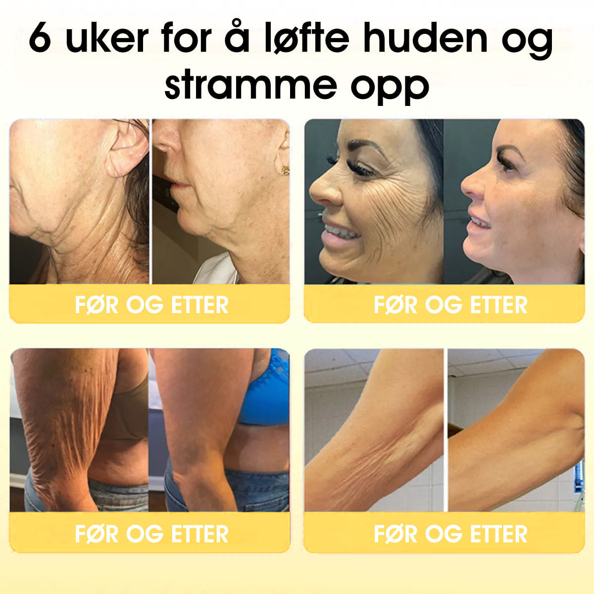 ✨💛Siste dag med 75 % rabatt! 🌻 Fubsta™ Oppstrammende Rynkefjernende Olje – Løft og stram opp huden din! 🧖‍♀️✨