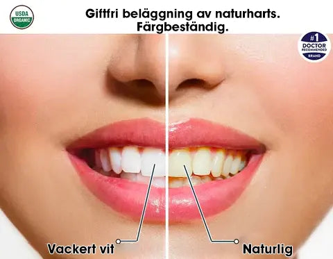 🌷😁 Sista dagen rabatt - 75% rabatt 💝 Senaste 👨‍⚕ Justerbar Snap-In Denture 🦷 - Exklusiva erbjudanden