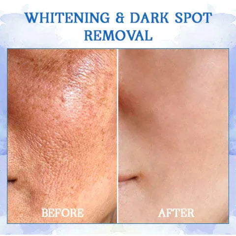 𝐒𝐢𝐬𝐭𝐞 𝐃𝐚𝐠 𝐌𝐞𝐝 𝐑𝐚𝐛𝐚𝐭𝐭: 𝟕5% 𝐀𝐕𝐒𝐋𝐀𝐆🩵🌊𝐅𝐮𝐛𝐬𝐭𝐚® Advanced SkinTightening Rejuvenating Cream: Gjenopprett Hudens Elastisitet💦