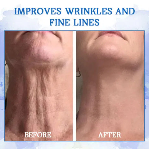 𝐒𝐢𝐬𝐭𝐞 𝐃𝐚𝐠 𝐌𝐞𝐝 𝐑𝐚𝐛𝐚𝐭𝐭: 𝟕5% 𝐀𝐕𝐒𝐋𝐀𝐆🩵🌊𝐅𝐮𝐛𝐬𝐭𝐚® Advanced SkinTightening Rejuvenating Cream: Gjenopprett Hudens Elastisitet💦