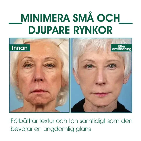 🔥👩‍⚕️Sista Dagen Kampanj 80% RABATT - Fubsta™ Hudstrammande Föryngrande Serum