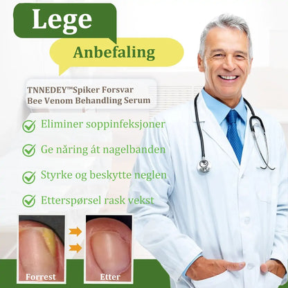 👩‍⚕️TNNEDEY™ Biegift Neglesopp Behandlingsløsning: Løs neglesopp-problemet fullstendig 🌟👣