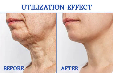 𝐒𝐢𝐬𝐭𝐞 𝐃𝐚𝐠 𝐌𝐞𝐝 𝐑𝐚𝐛𝐚𝐭𝐭: 𝟕5% 𝐀𝐕𝐒𝐋𝐀𝐆🩵🌊𝐅𝐮𝐛𝐬𝐭𝐚® Advanced SkinTightening Rejuvenating Cream: Gjenopprett Hudens Elastisitet💦