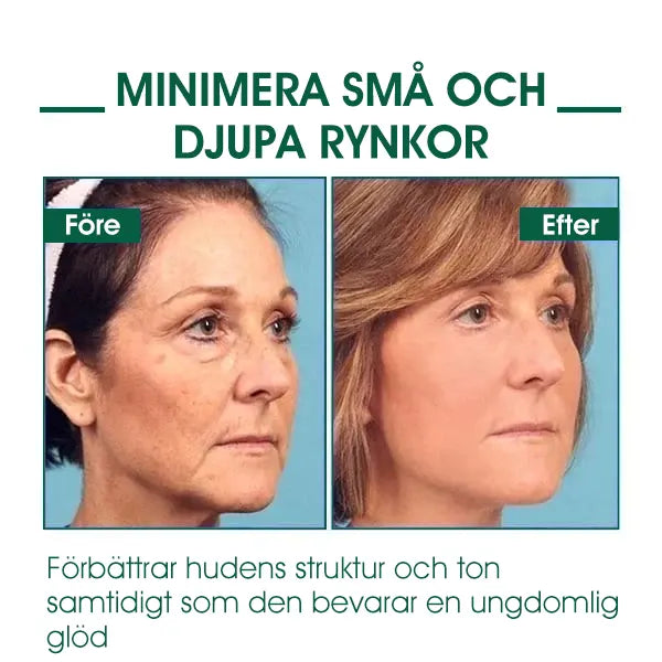 🔥👩‍⚕️Sista Dagen Kampanj 80% RABATT - Fubsta™ Hudstrammande Föryngrande Serum