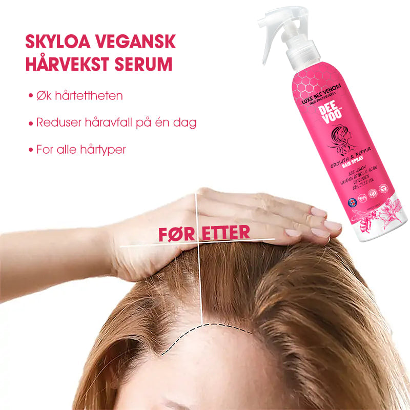 DeeVoo™ Luxe Bee Venom Scalp Treatment HairGrowth Hair Spray (Skynd deg, 80 % RABATT – Kun 30 minutter igjen 🫧)