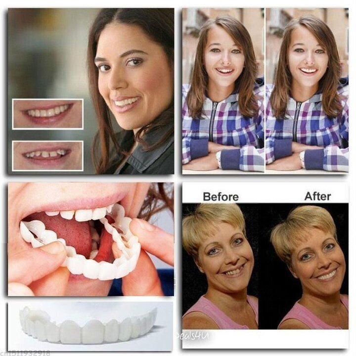 🌷😁 Sista dagen rabatt - 75% rabatt 💝 Senaste 👨‍⚕ Justerbar Snap-In Denture 🦷 - Exklusiva erbjudanden